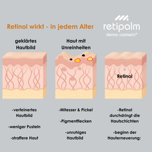 ACTIVE RETINOL 1
